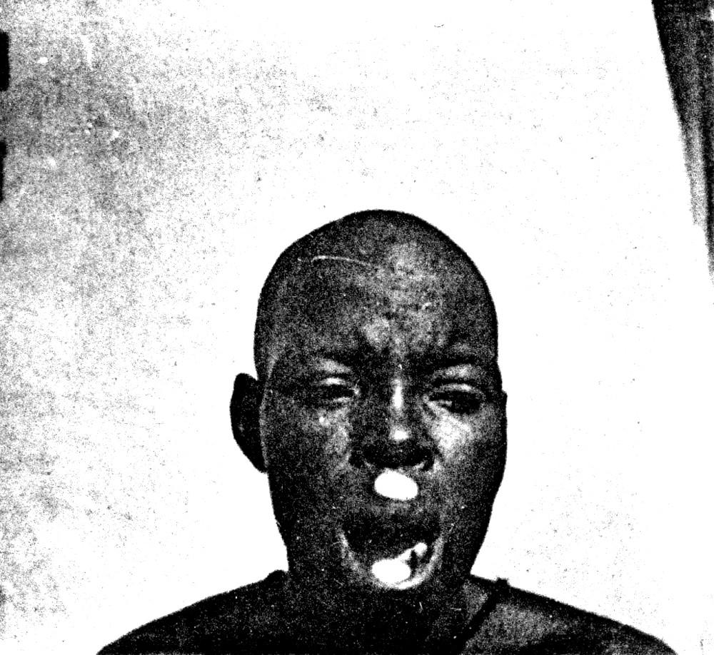 Femme lobi avec labret 1931 Labouret